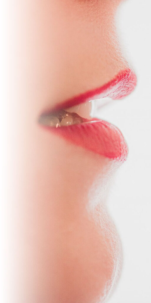 Gummy Smile Botox Treatment El Paso - Aro Med Spa