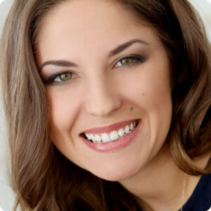 Gummy Smile Botox Treatment El Paso TX - Aro Med Spa